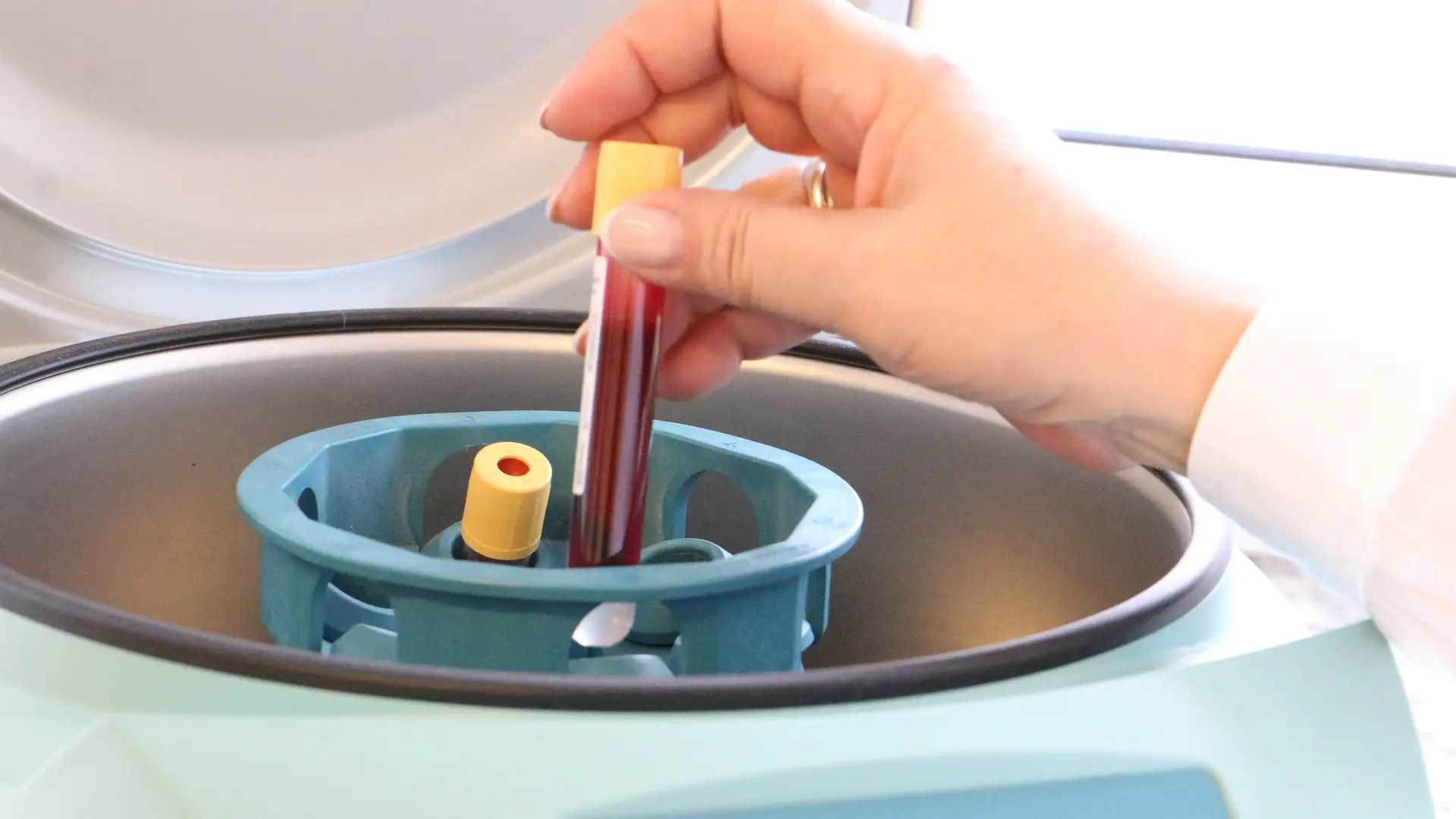 Análisis de sangre Análisis de sangre