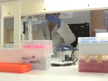 Sanidad finaliza el seguimiento del brote de listeriosis Sanidad finaliza el seguimiento del brote de listeriosis