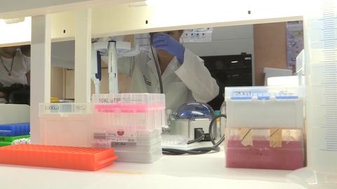 Sanidad finaliza el seguimiento del brote de listeriosis