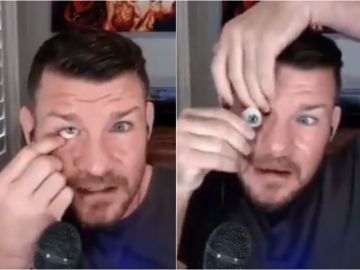 El luchador Michael Bisping se quita un ojo en directo