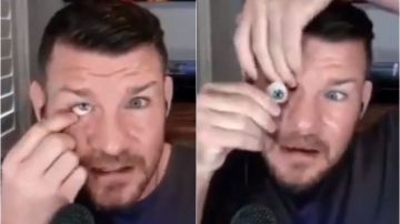 El luchador Michael Bisping se quita un ojo en directo