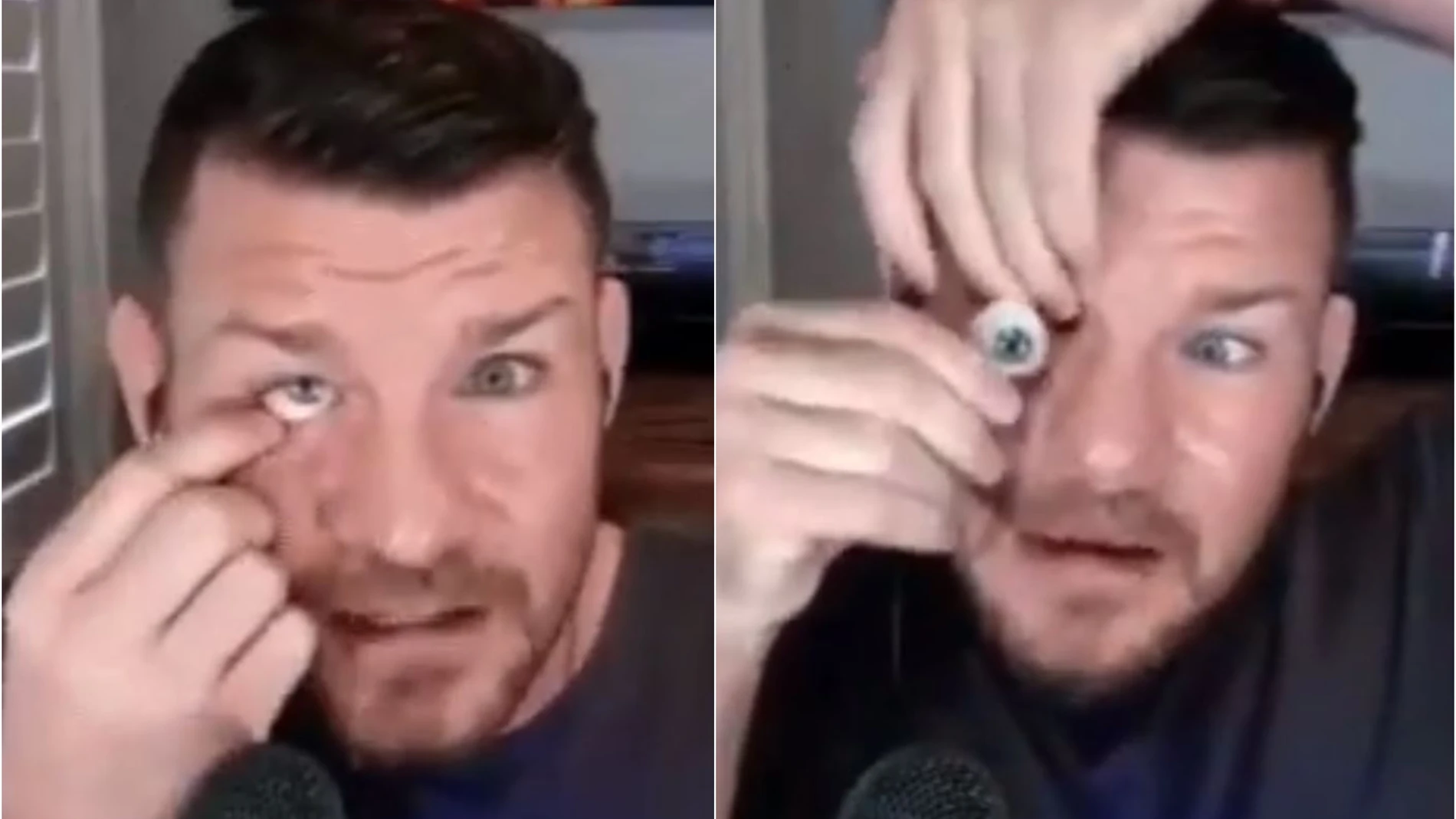 El luchador Michael Bisping se quita un ojo en directo El luchador Michael Bisping se quita un ojo en directo