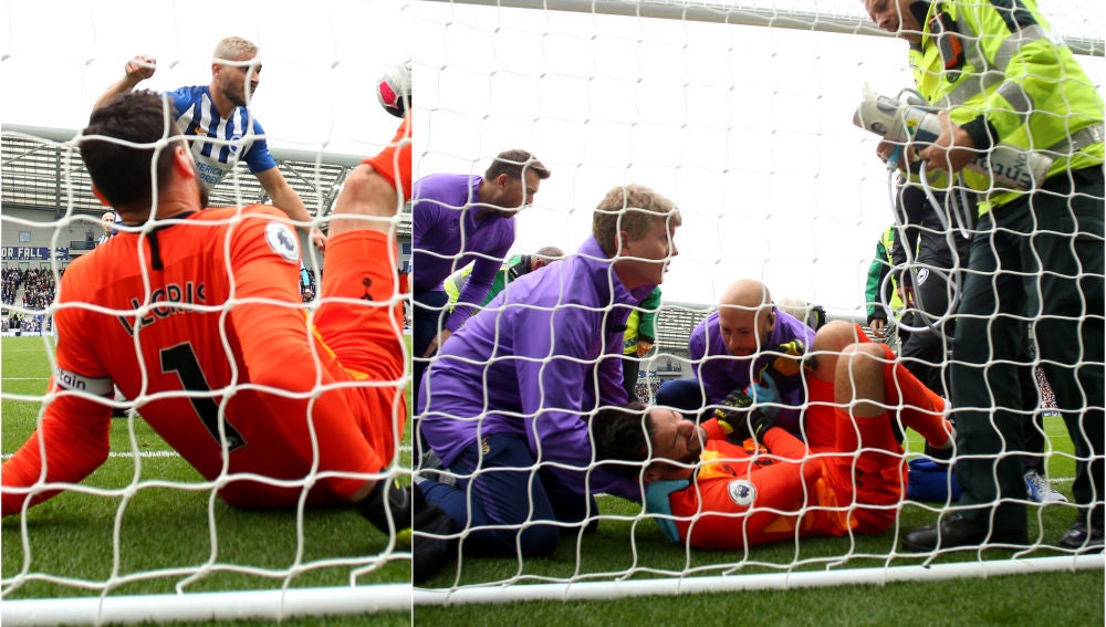 Así se a lesionado Hugo Lloris