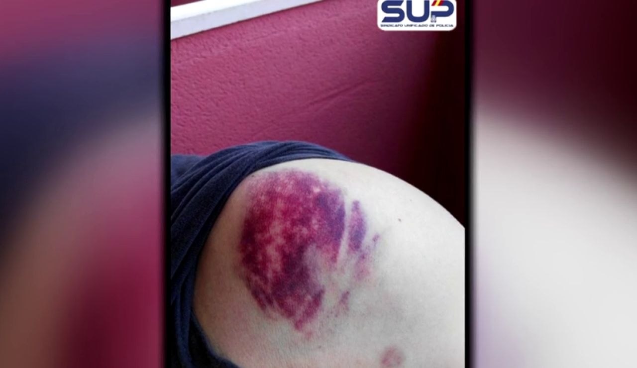 Los sindicatos policiales denuncian que los violentos "buscan la muerte de un policía" Los sindicatos policiales denuncian que los violentos "buscan la muerte de un policía"