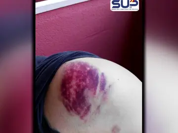 Los sindicatos policiales denuncian que los violentos "buscan la muerte de un policía" Los sindicatos policiales denuncian que los violentos "buscan la muerte de un policía"