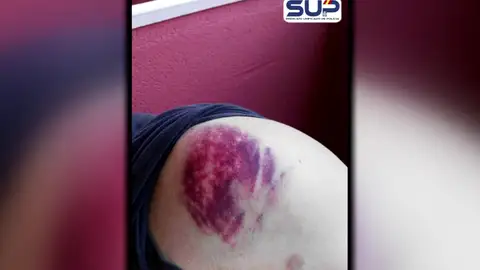 Los sindicatos policiales denuncian que los violentos "buscan la muerte de un policía" Los sindicatos policiales denuncian que los violentos "buscan la muerte de un policía"