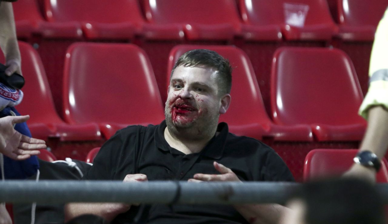 Hincha del Bayern agredido Hincha del Bayern agredido
