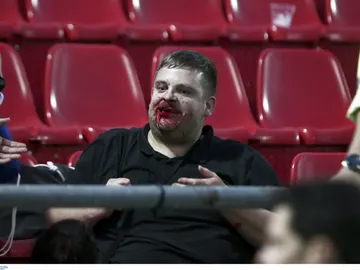 Hincha del Bayern agredido Hincha del Bayern agredido