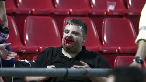 Hincha del Bayern agredido Hincha del Bayern agredido