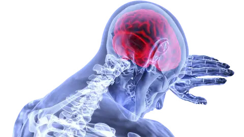 Ictus Ictus