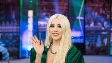 Ava Max cuenta en 'El Hormiguero 3.0' el accidente que explica su extraño corte de pelo 