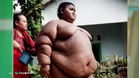 El impactante cambio físico del 'niño más obeso del mundo' que llegó a pesar 200 kilos El impactante cambio físico del 'niño más obeso del mundo' que llegó a pesar 200 kilos