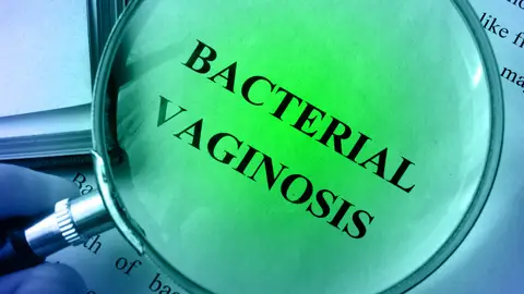 Vaginosis bacteriana Vaginosis bacteriana