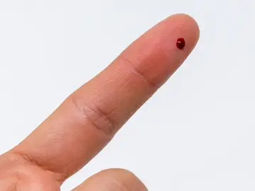 Prueba Coronavirus: Pinchazo en el dedo Prueba Coronavirus: Pinchazo en el dedo