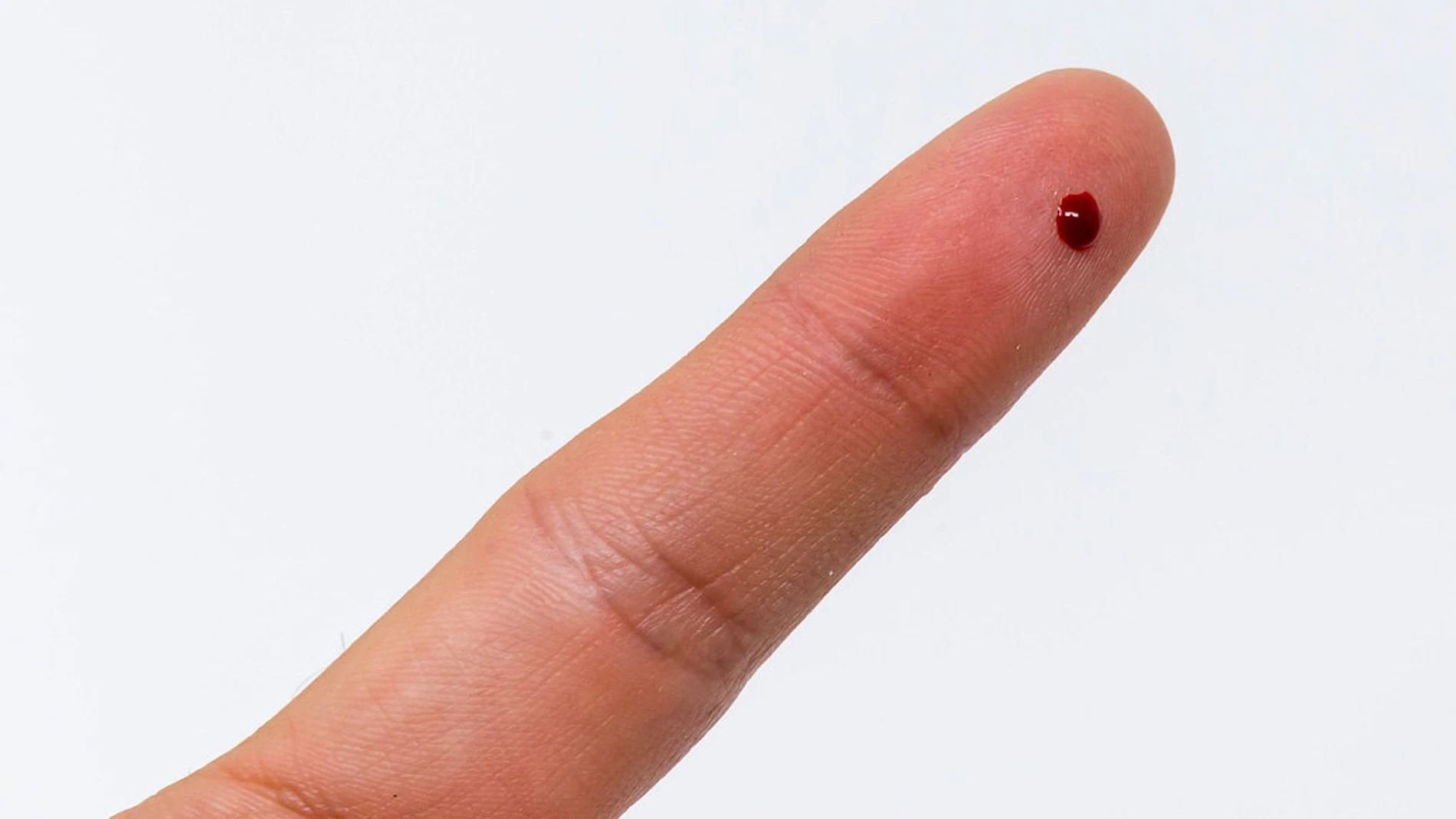 Prueba Coronavirus: Pinchazo en el dedo Prueba Coronavirus: Pinchazo en el dedo