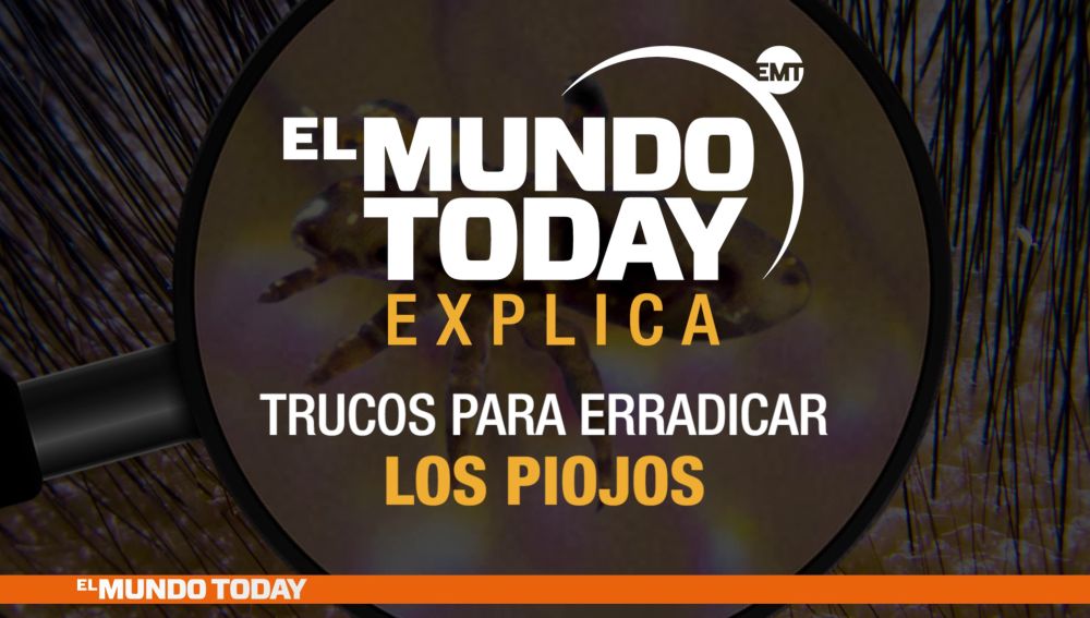 como eliminar los piojos rapido