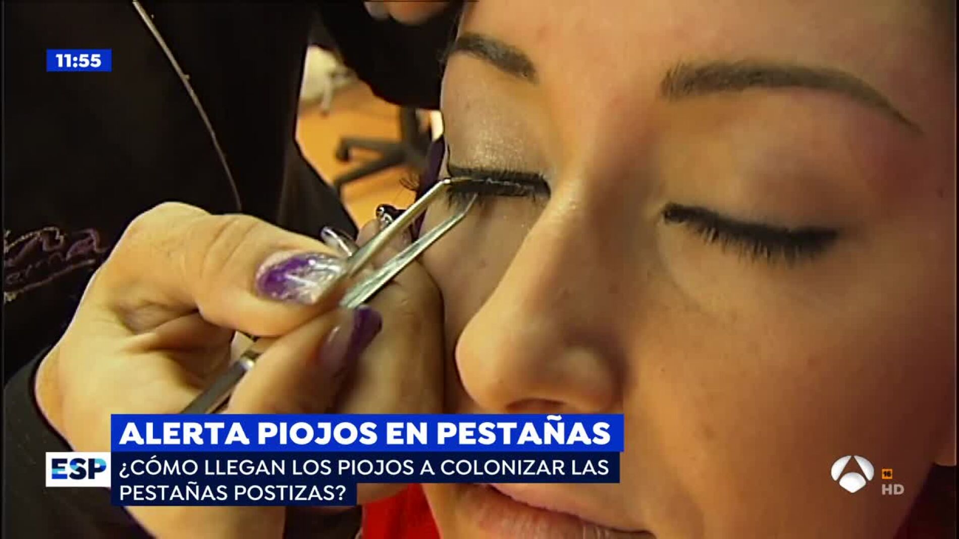 Piojos en las pesta&ntilde;as postizas.