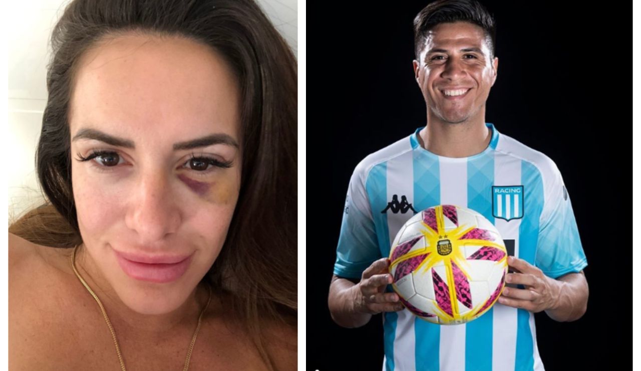 Morella de las Heras, agredida por el jugador Jonatan Cristaldo Morella de las Heras, agredida por el jugador Jonatan Cristaldo