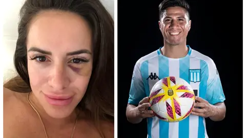 Morella de las Heras, agredida por el jugador Jonatan Cristaldo Morella de las Heras, agredida por el jugador Jonatan Cristaldo