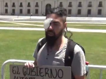 Decenas de manifestantes pierden un ojo en las protestas 