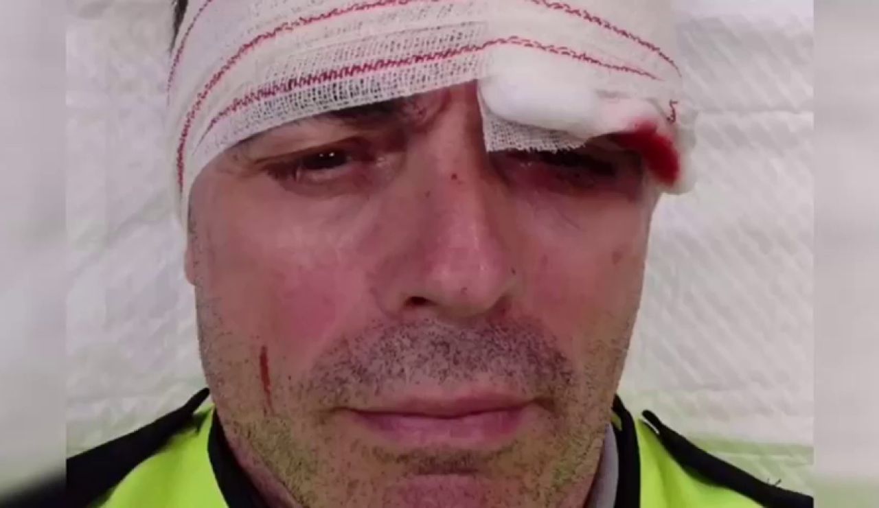 Tres vigilantes de Renfe, brutalmente agredidos al intervenir en una pelea en un tren en Barcelona Tres vigilantes de Renfe, brutalmente agredidos al intervenir en una pelea en un tren en Barcelona
