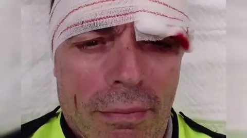 Tres vigilantes de Renfe, brutalmente agredidos al intervenir en una pelea en un tren en Barcelona Tres vigilantes de Renfe, brutalmente agredidos al intervenir en una pelea en un tren en Barcelona