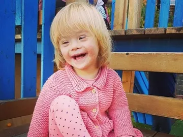 Alba, una pequeña con Síndrome de Down Alba, una pequeña con Síndrome de Down