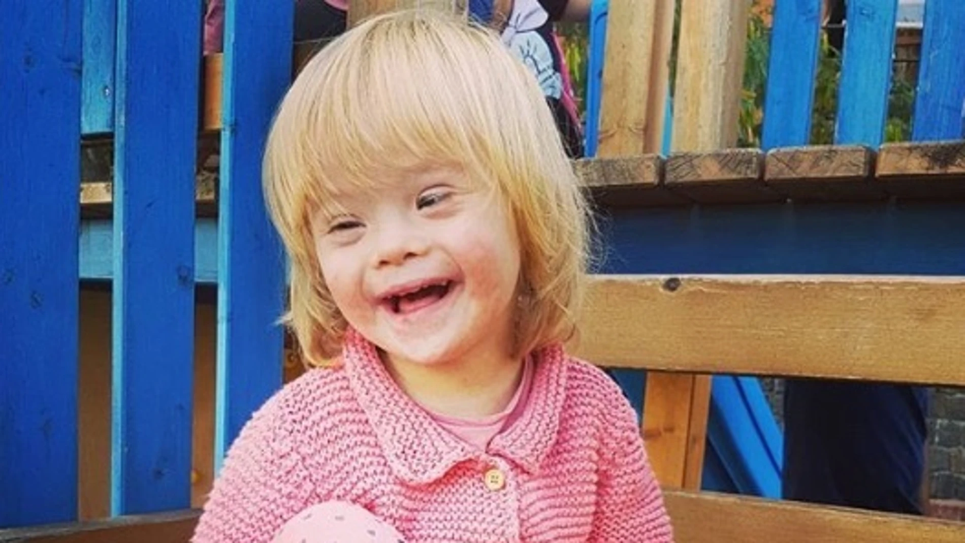 Alba, una pequeña con Síndrome de Down Alba, una pequeña con Síndrome de Down