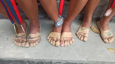 Rhea Bullos y sus vendas que se puso para correr Rhea Bullos y sus vendas que se puso para correr