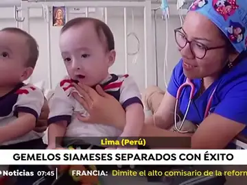 GEMELOS SIAMESES GEMELOS SIAMESES