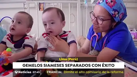 GEMELOS SIAMESES GEMELOS SIAMESES