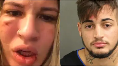 Milena Bemfica y su marido Jean Paulo Fernandes Filho Milena Bemfica y su marido Jean Paulo Fernandes Filho