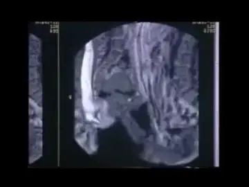 La imagen de una penetración vaginal a través de una resonancia La imagen de una penetración vaginal a través de una resonancia