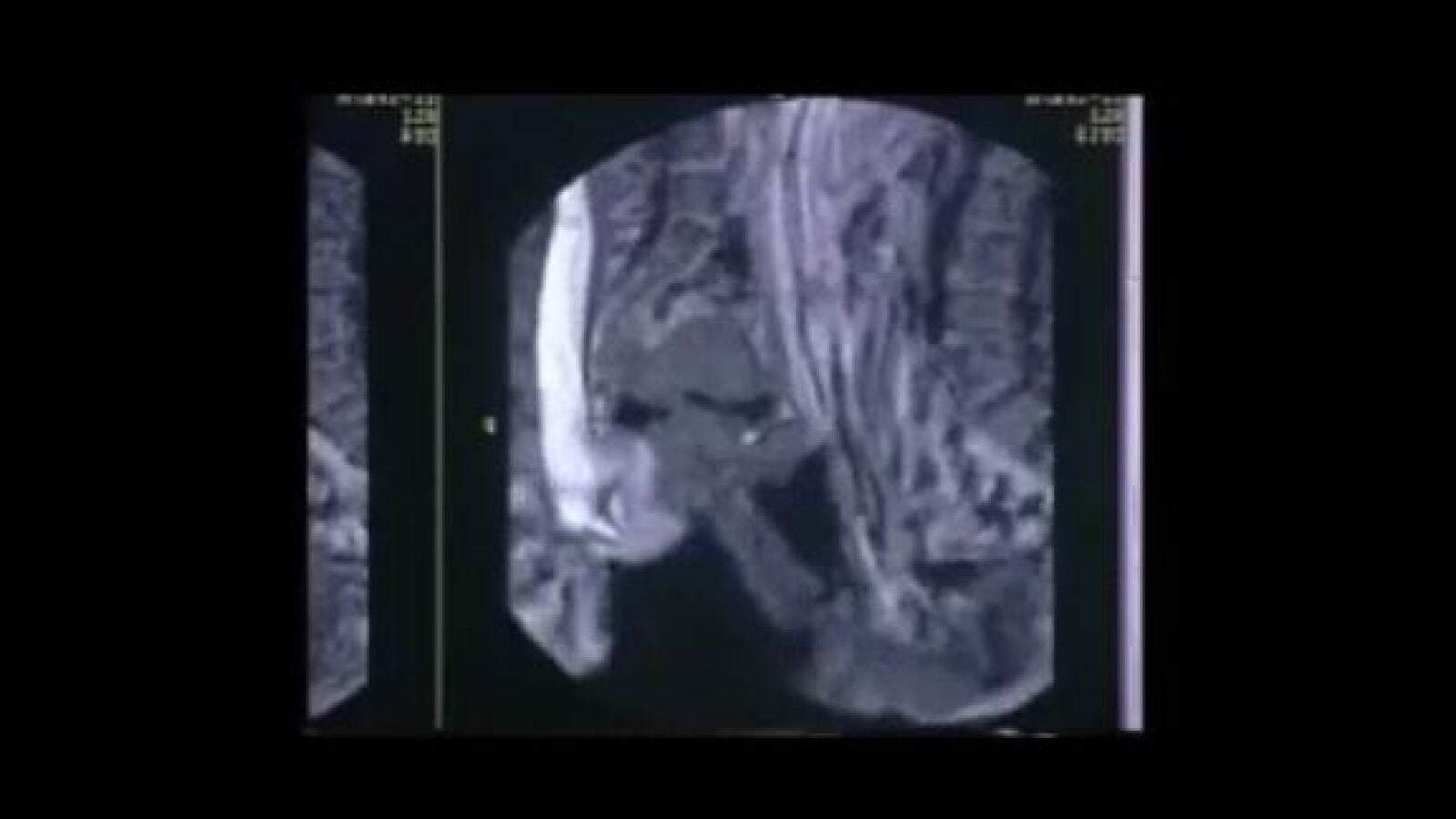 Sexo en una resonancia, el vídeo más visto en los 20 años de la revista científica British Medical Journal
