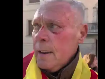 Agredido en la manifestación de Vox en Cornellà Agredido en la manifestación de Vox en Cornellà