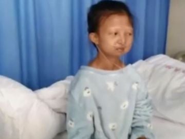 Muere Wu Huayan, la joven china que pasó cinco años comiendo arroz