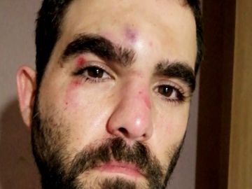 El periodista Robert Calvo es agredido en el Raval