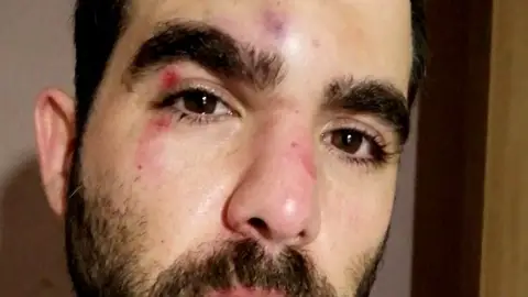 El periodista Robert Calvo es agredido en el Raval El periodista Robert Calvo es agredido en el Raval