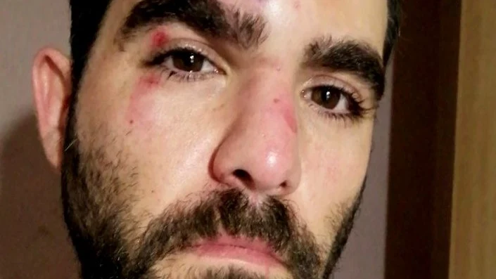 El periodista Robert Calvo es agredido en el Raval El periodista Robert Calvo es agredido en el Raval