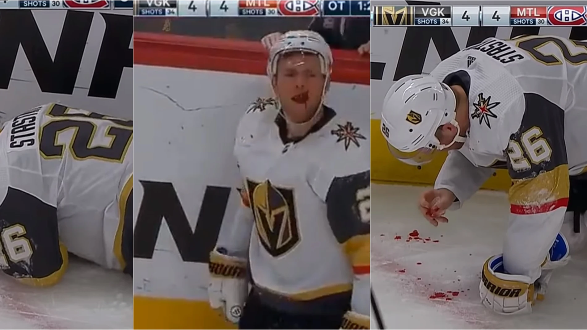 Paul Stastny, en el momento de su terrible golpe en la cara Paul Stastny, en el momento de su terrible golpe en la cara