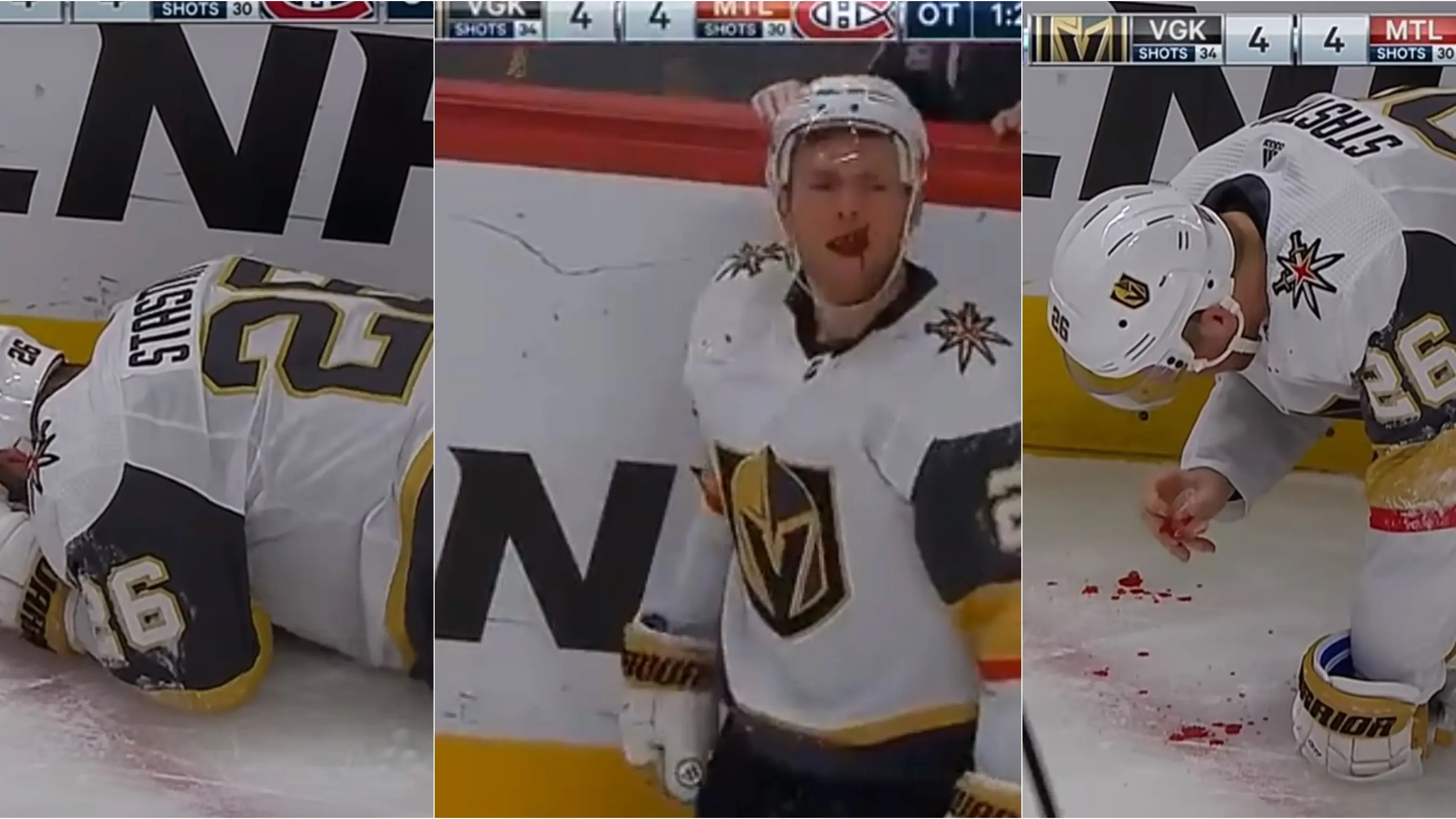 Paul Stastny, en el momento de su terrible golpe en la cara Paul Stastny, en el momento de su terrible golpe en la cara