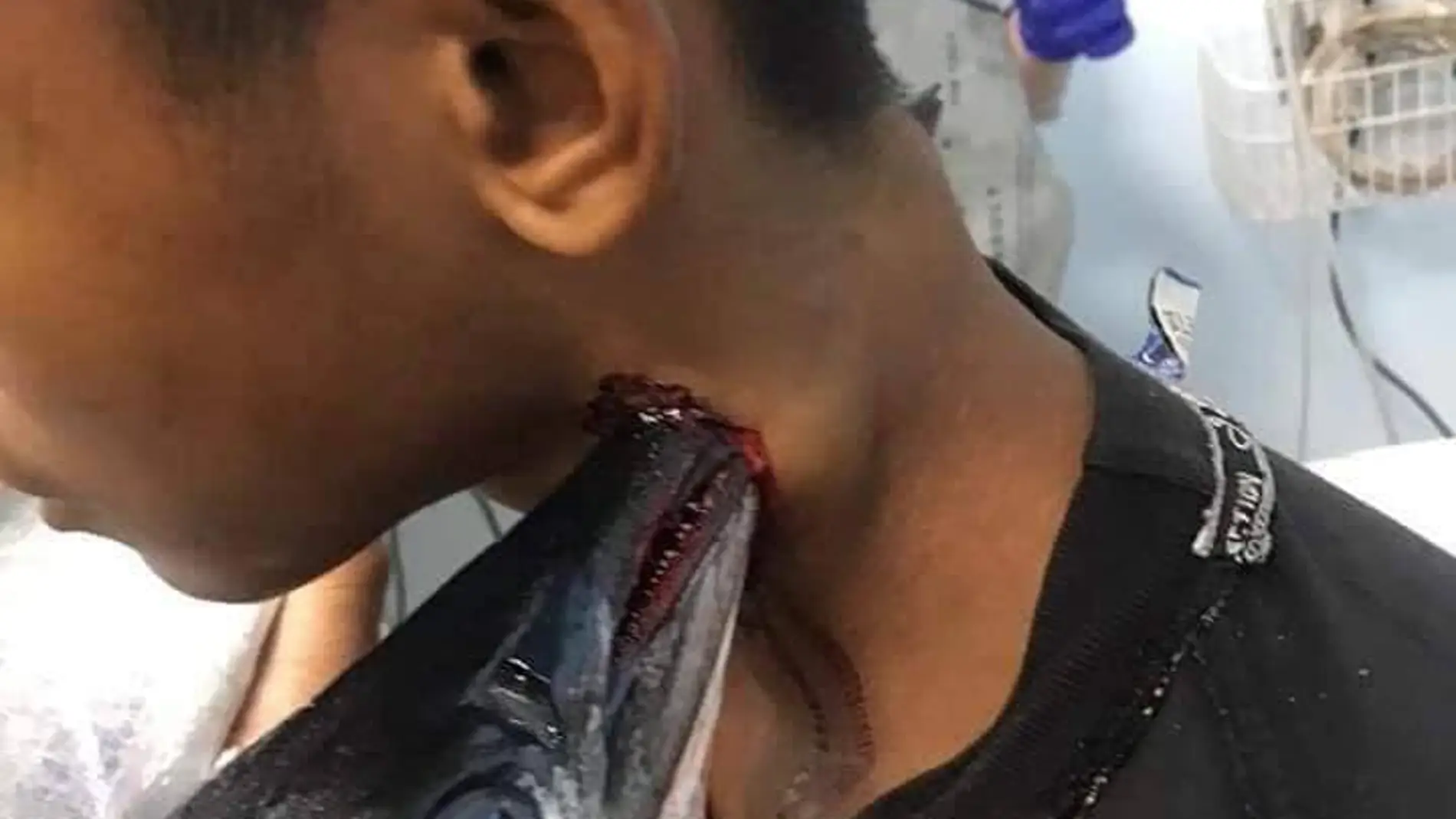 Un pez espada le atraviesa el cuello Un pez espada le atraviesa el cuello