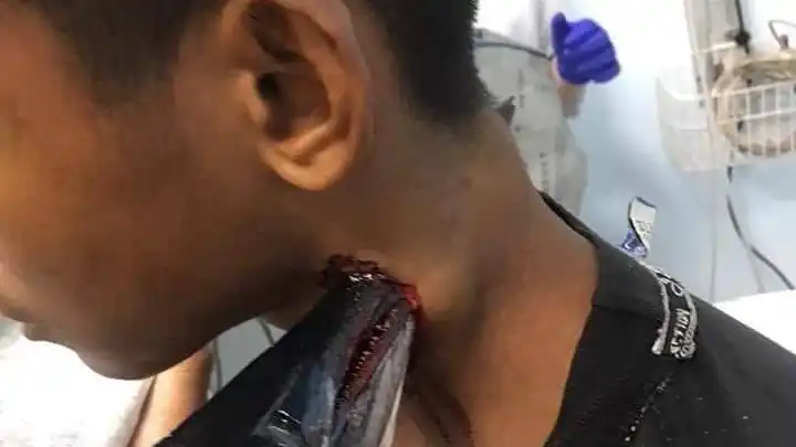 Un pez espada le atraviesa el cuello Un pez espada le atraviesa el cuello