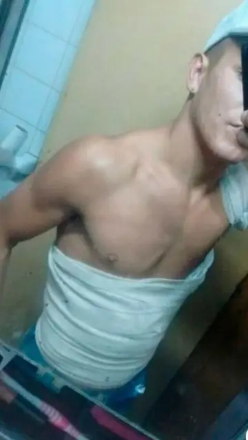 Así quedó el torso del joven Así quedó el torso del joven
