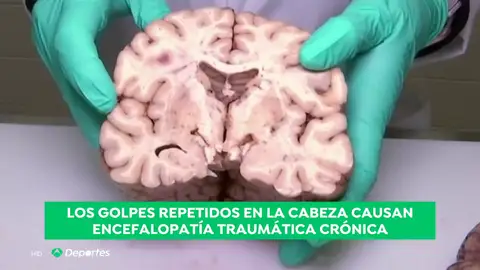 GOLPESCABEZA GOLPESCABEZA