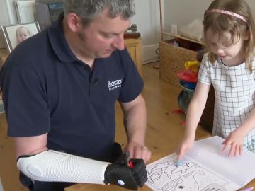 Vuelve a jugar con su hija gracias a un brazo biónico impreso en 3D