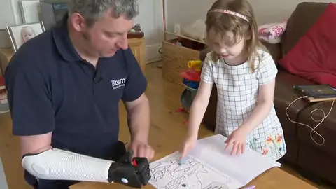 Vuelve a jugar con su hija gracias a un brazo biónico impreso en 3D Vuelve a jugar con su hija gracias a un brazo biónico impreso en 3D