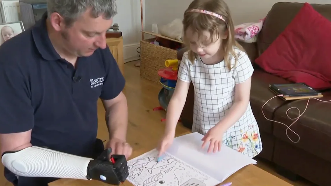 Vuelve a jugar con su hija gracias a un brazo biónico impreso en 3D Vuelve a jugar con su hija gracias a un brazo biónico impreso en 3D