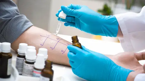 Prueba de alergia Prueba de alergia