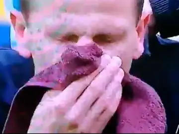 Maciej Dabrowski del LKS Lodz se rompe la nariz haciendo una chilena Maciej Dabrowski del LKS Lodz se rompe la nariz haciendo una chilena
